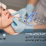 مرکز لیزر و زیبایی آریان، پیشرفته‌ترین لیزر شهرک غـرب