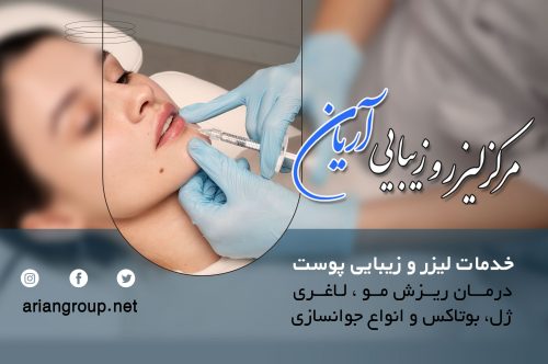 مرکز لیزر و زیبایی آریان، پیشرفته‌ترین لیزر شهرک غـرب