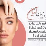 بهترین زمان تزریق بوتاکس برای یک مجلس یا رویداد مهم