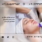 لیزر تمام بدن چقدر طول می‌کشد در مرکز لیزر و زیبایی آریان