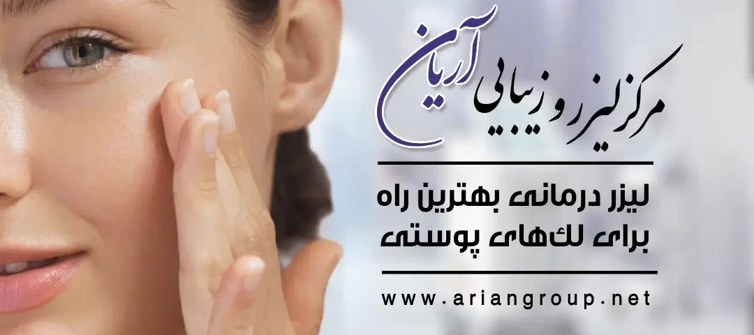 لیزر درمانی لکه‌های پوستی