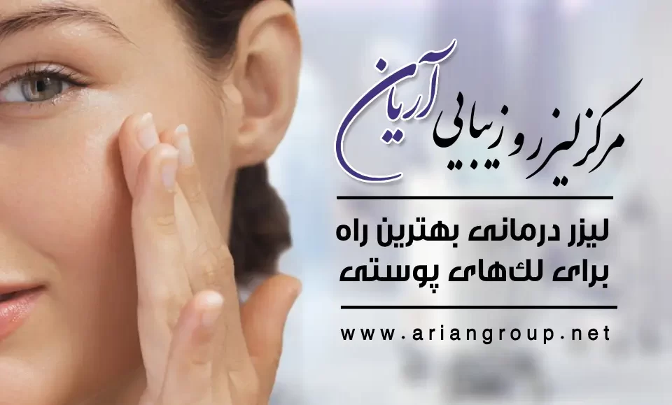 لیزر درمانی لکه‌های پوستی