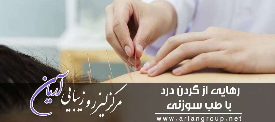 رهایی از گردن درد با طب سوزنی