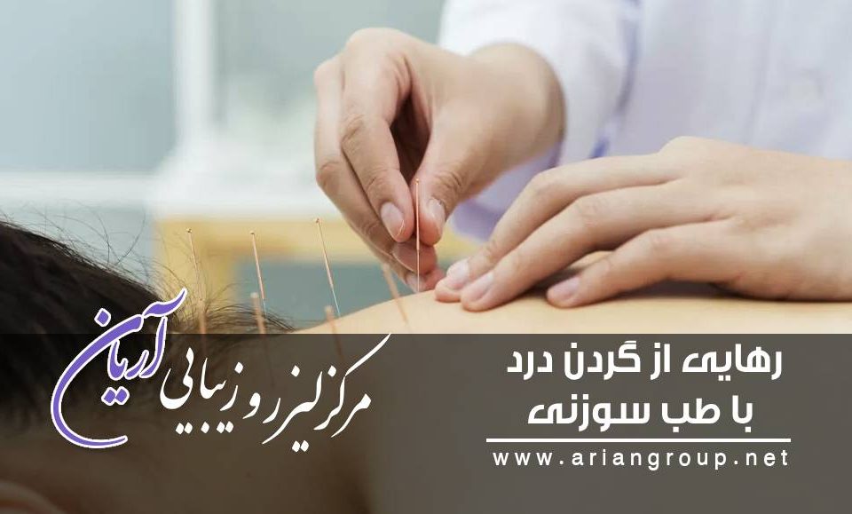 رهایی از گردن درد با طب سوزنی