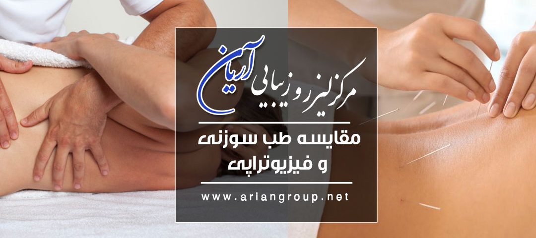 مقایسه طب سوزنی و فیزیوتراپی