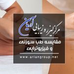 مقایسه طب سوزنی و فیزیوتراپی