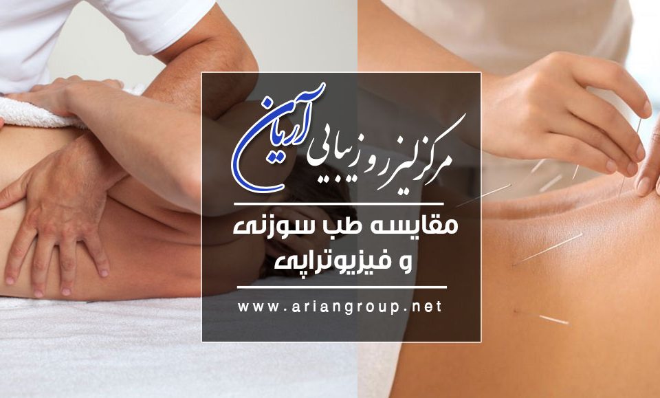 مقایسه طب سوزنی و فیزیوتراپی