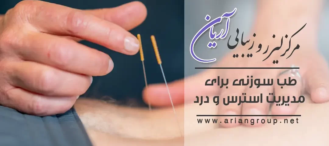 مدیریت استرس و درد با طب سوزنی