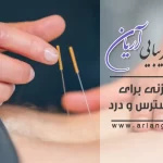 مدیریت استرس و درد با طب سوزنی