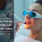 چه مدت بعد از لیزر نتایج جوانسازی را روی صورت خود می‌بینم؟