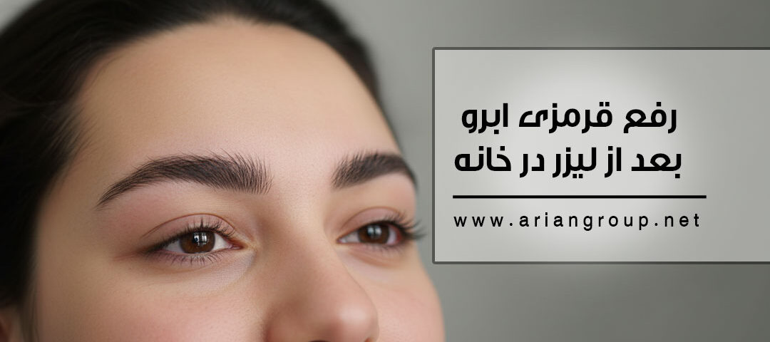 رفع قرمزی ابرو بعد از لیزر در خانه