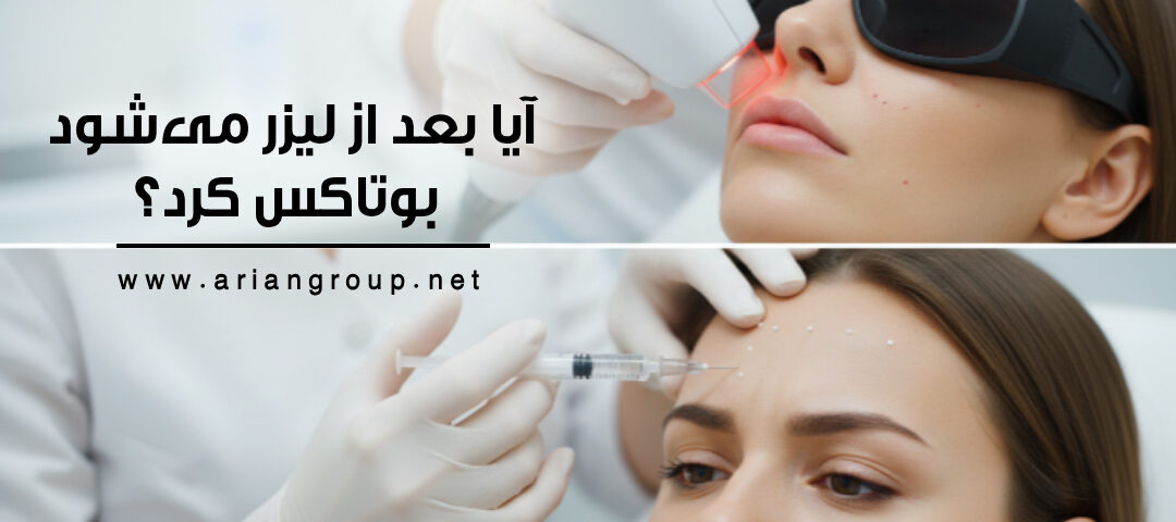 بوتاکس بعد از لیزر